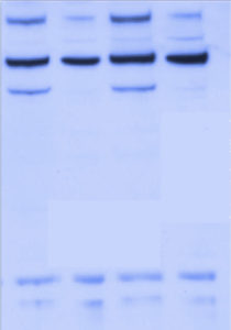[Fig .A] Western blots completed by traditional manual procedure - please note the nonspeciﬁc bands seen on the blot.